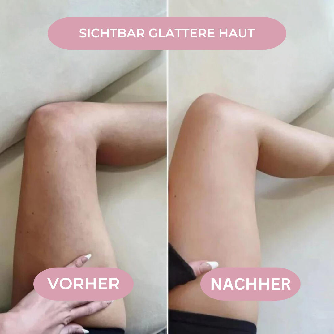 Slimora Anti Cellulite
